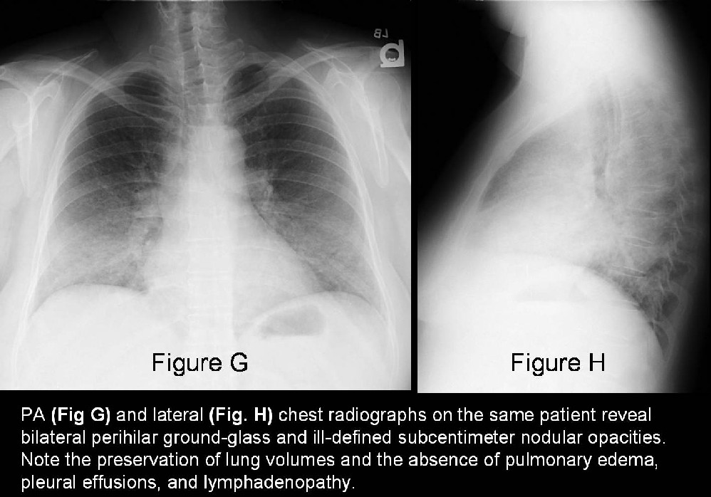Radiograph 5 from archived case 22
