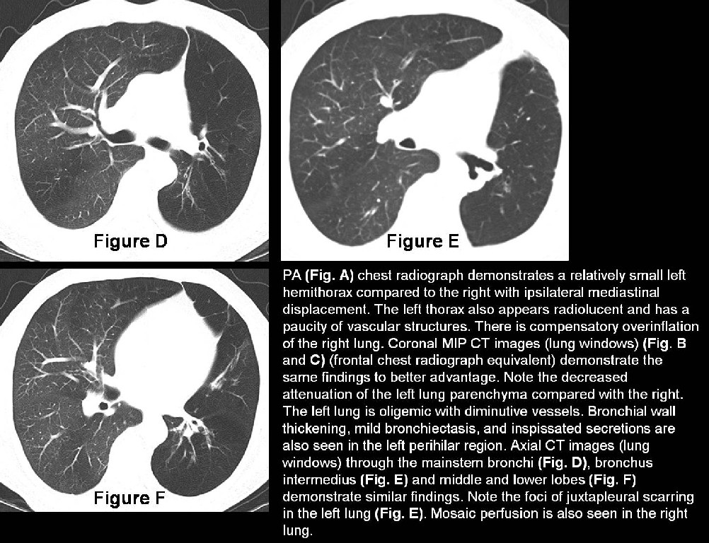 Radiograph 4 from archived case 36