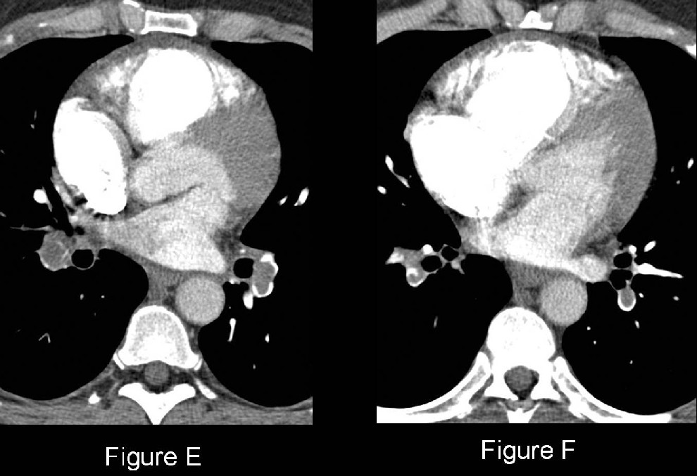 Radiograph 6 from archived case 41