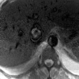 Radiograph 3 from archived case 30