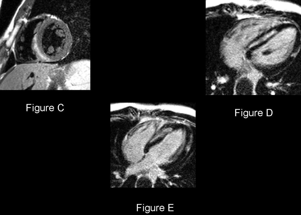Radiograph 3 from archived case 50