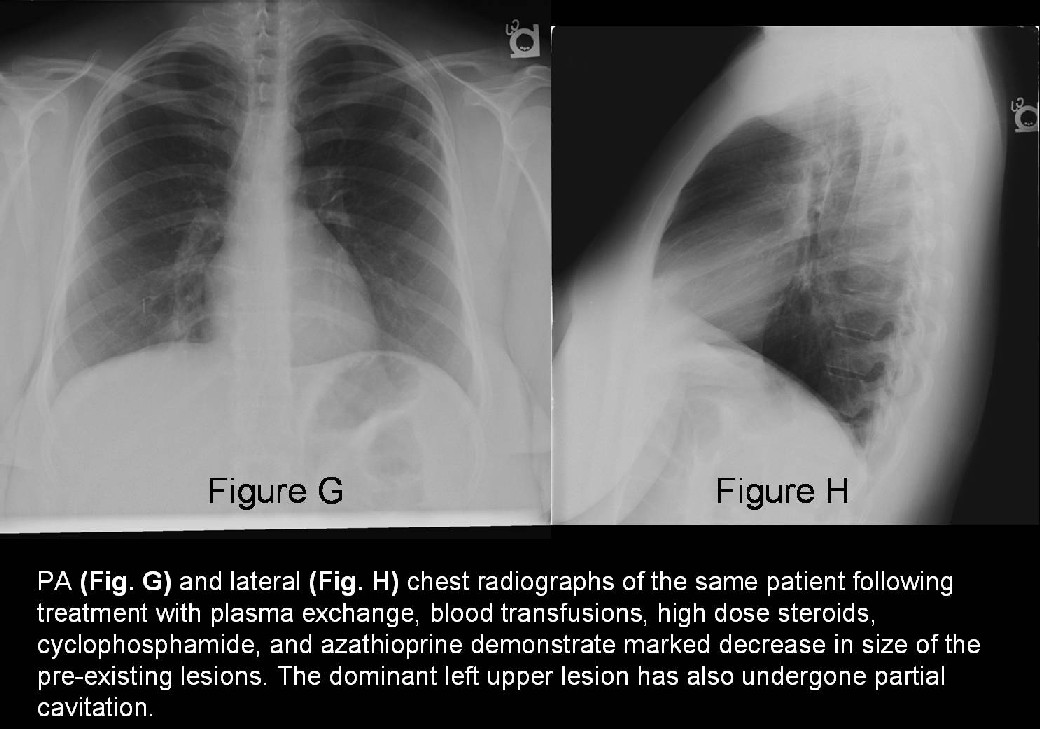 Radiograph 6 from archived case 33