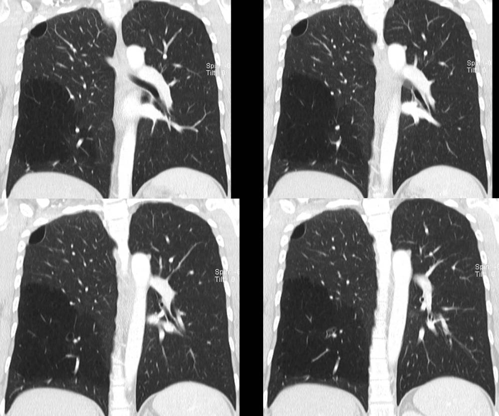 Radiograph 3 from archived case 54