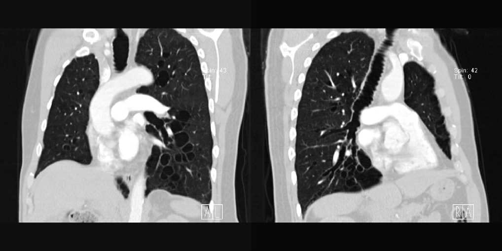 Radiograph 3 from archived case 7