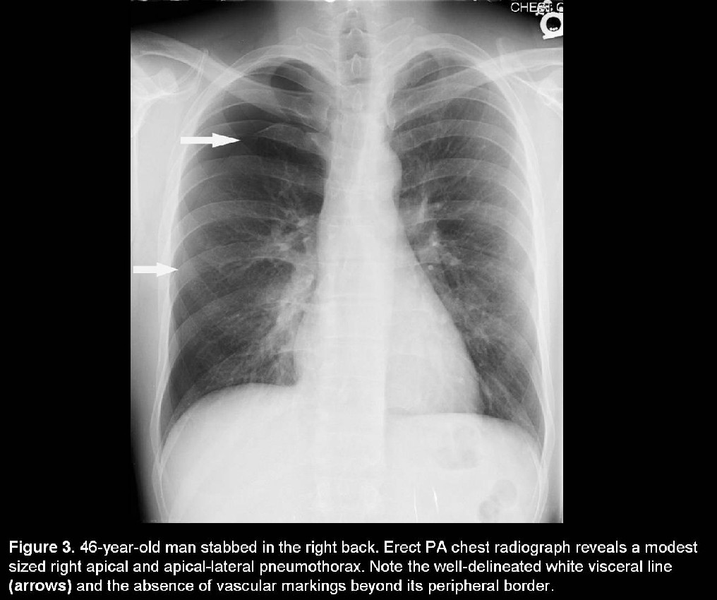 Radiograph 4 from archived case 34