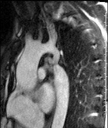 Radiograph 3 from archived case 57