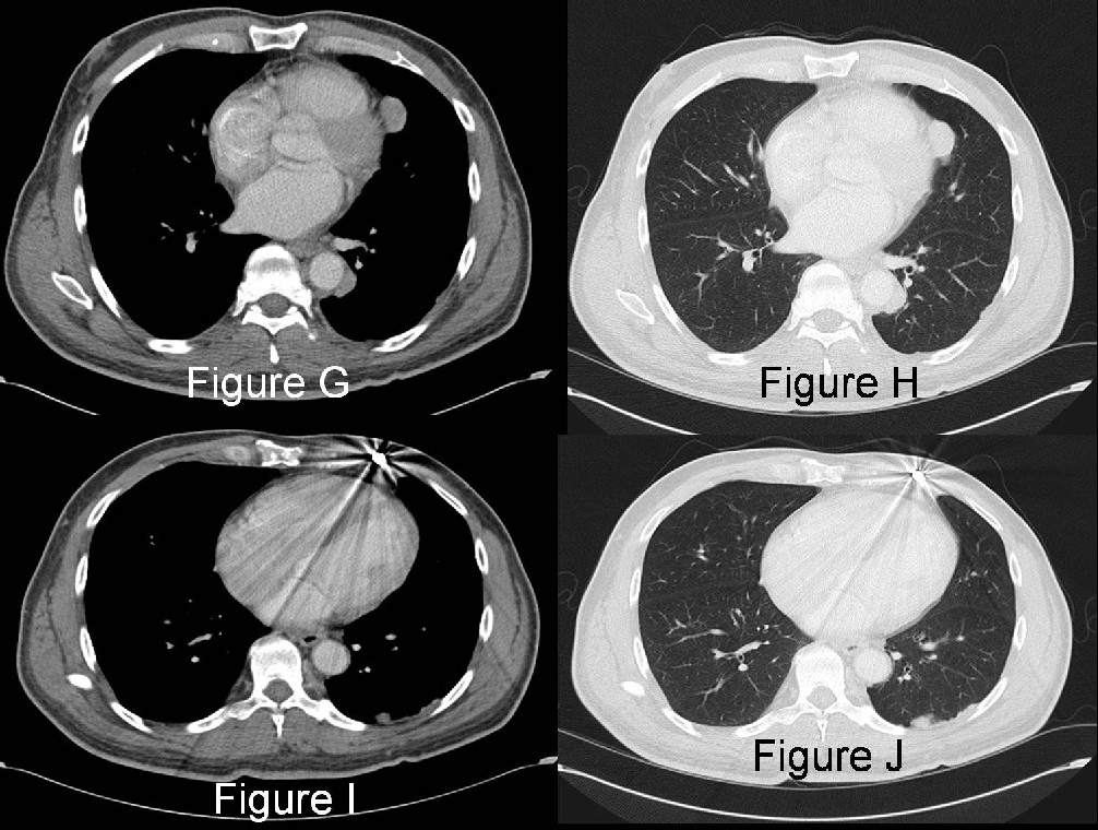 Radiograph 4 from archived case 15
