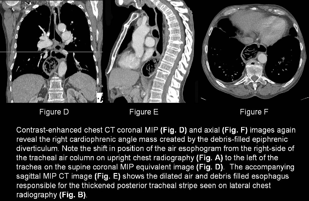 Radiograph 5 from archived case 26