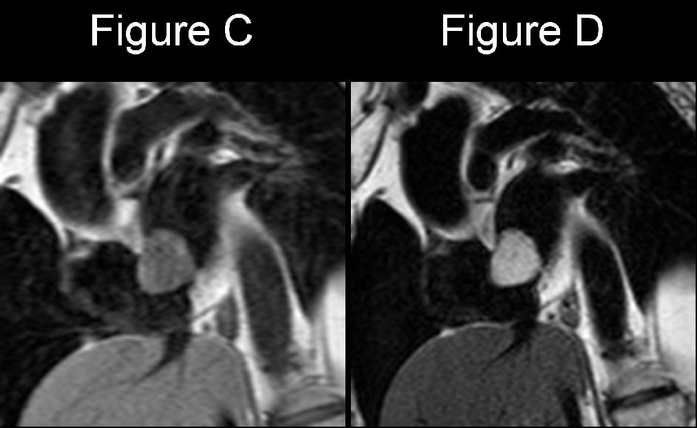 Radiograph 8 from archived case 20