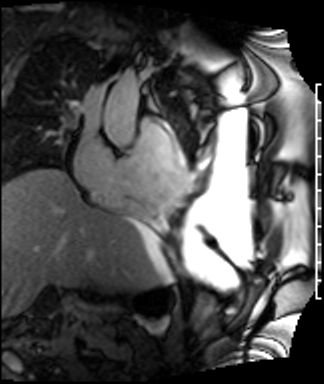 Radiograph 3 from archived case 42