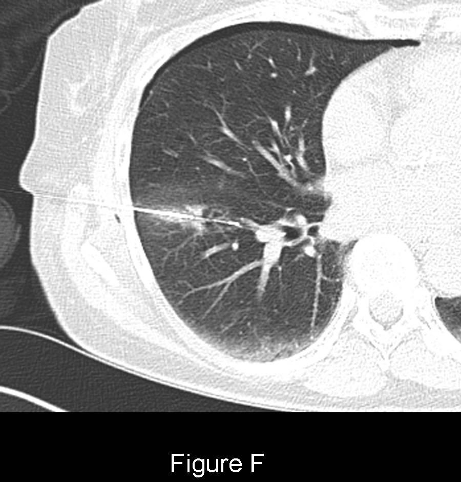 Radiograph 4 from archived case 47