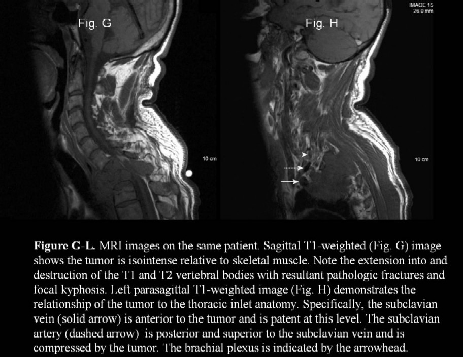 Radiograph 4 from archived case 28