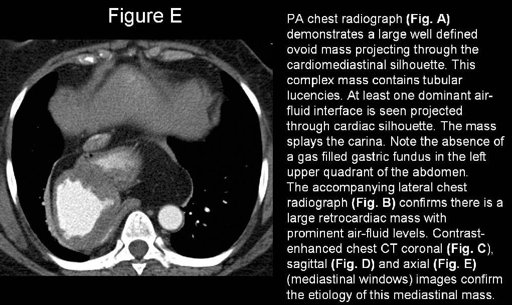Radiograph 4 from archived case 19