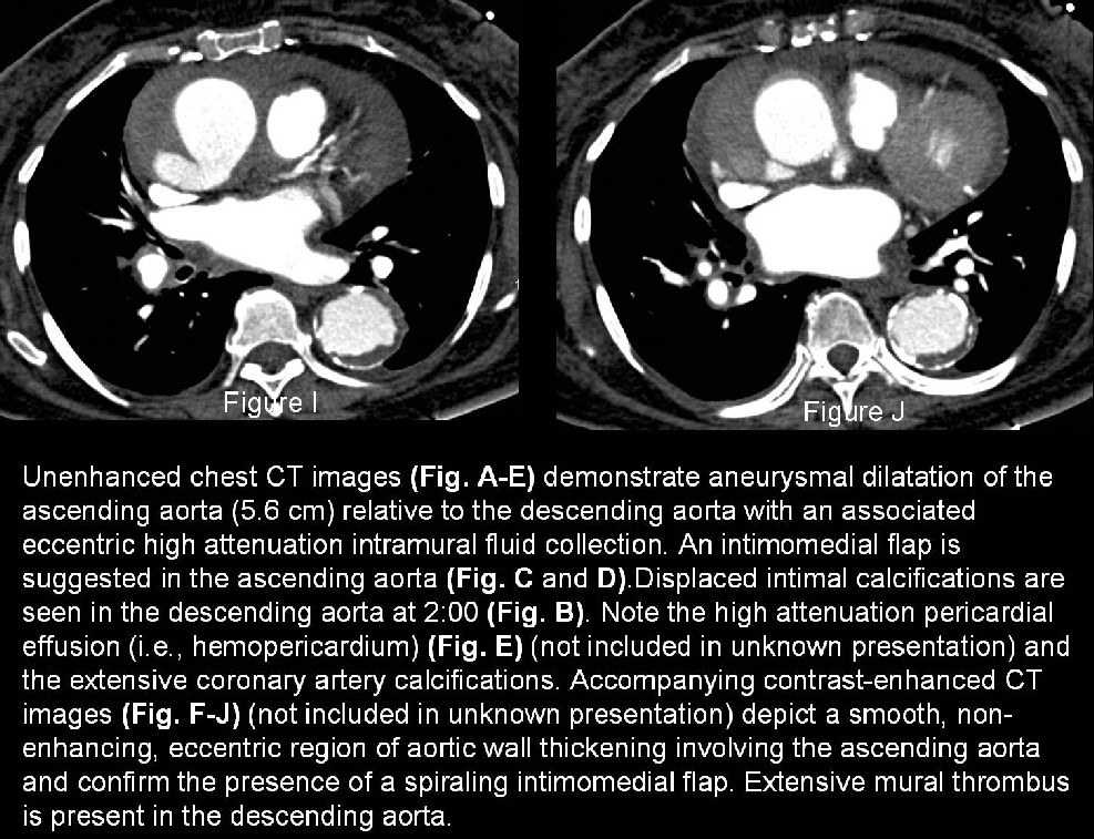 Radiograph 4 from archived case 25