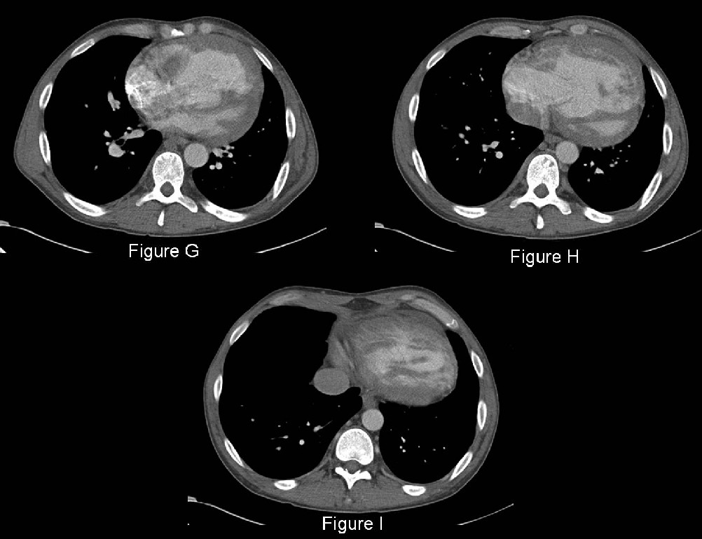 Radiograph 6 from archived case 40