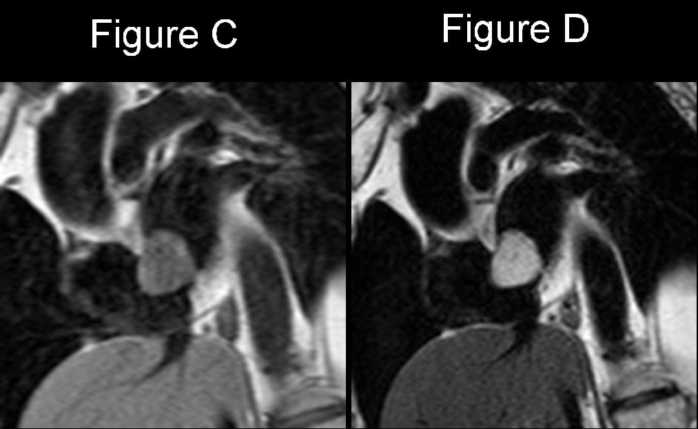 Radiograph 3 from archived case 20