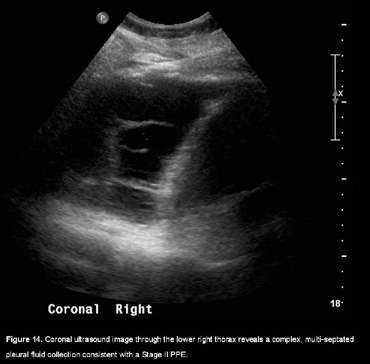 Radiograph 5 from archived case 5