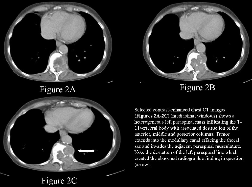 Radiograph 5 from archived case 11