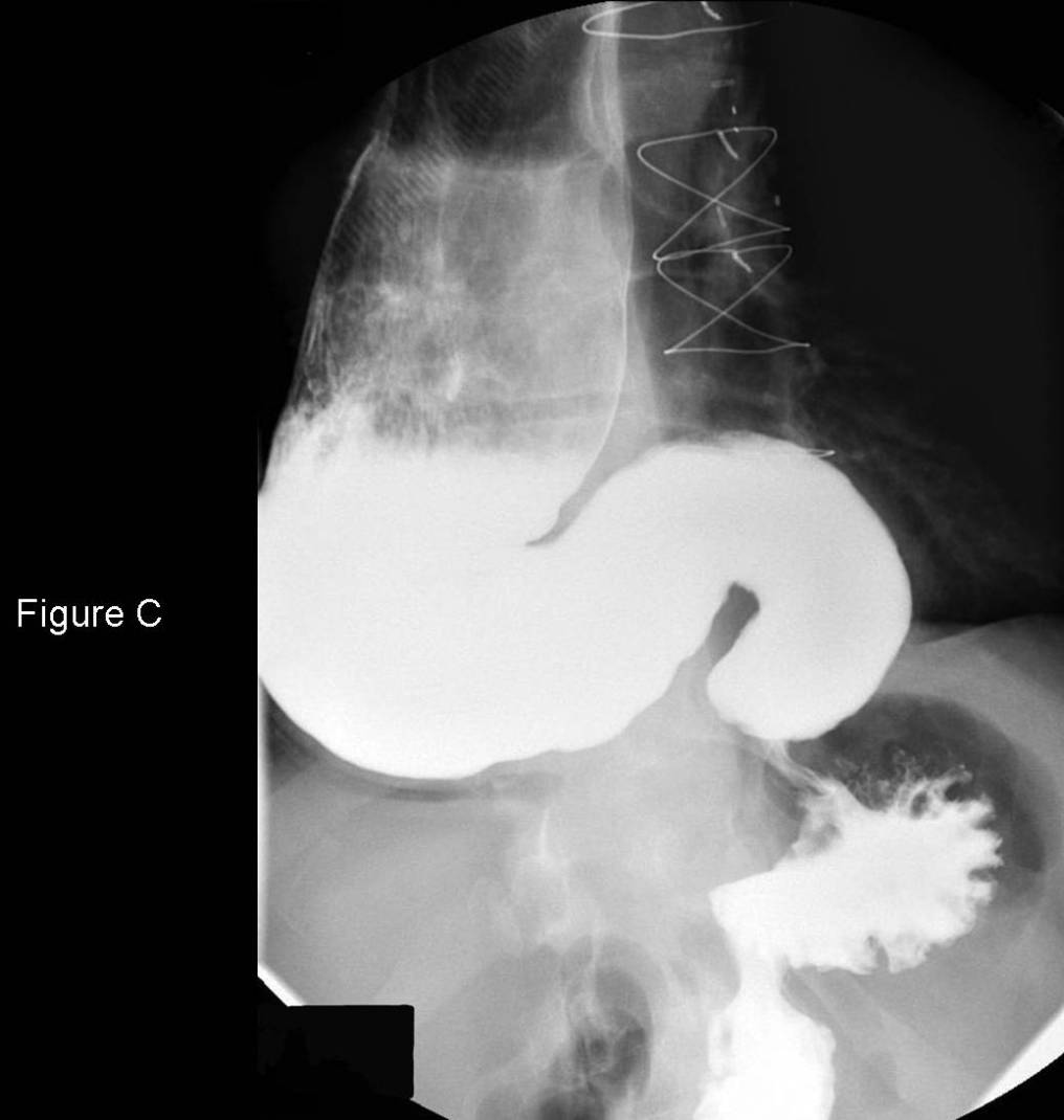 Radiograph 5 from archived case 45