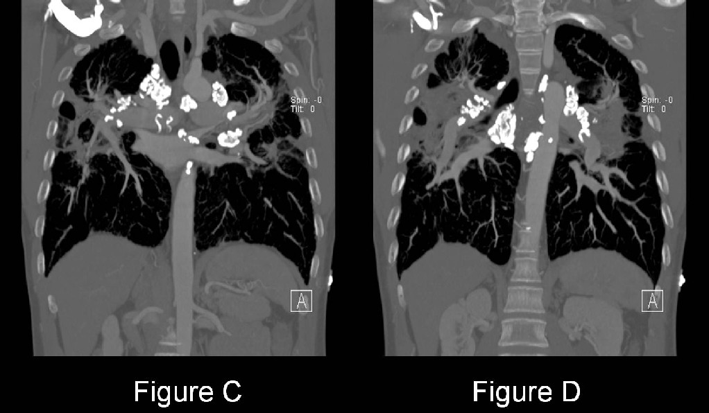 Radiograph 4 from archived case 21