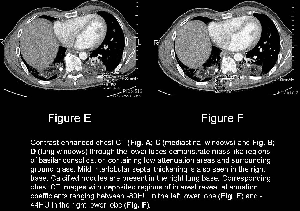 Radiograph 5 from archived case 14