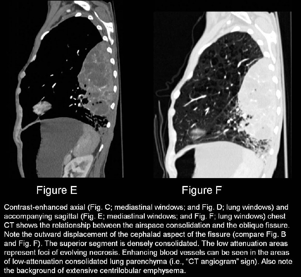 Radiograph 4 from archived case 13