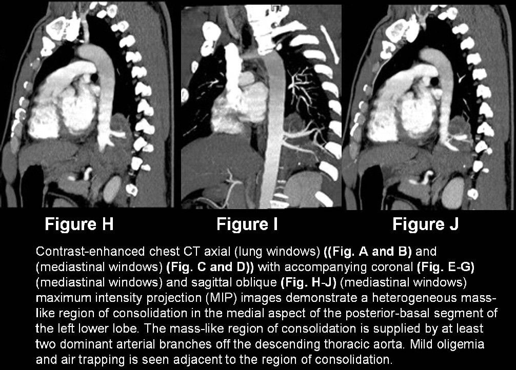 Radiograph 6 from archived case 18