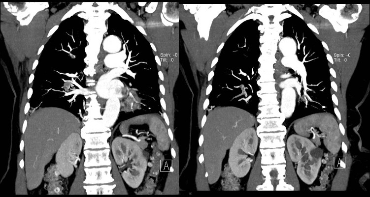 Radiograph 3 from archived case 3