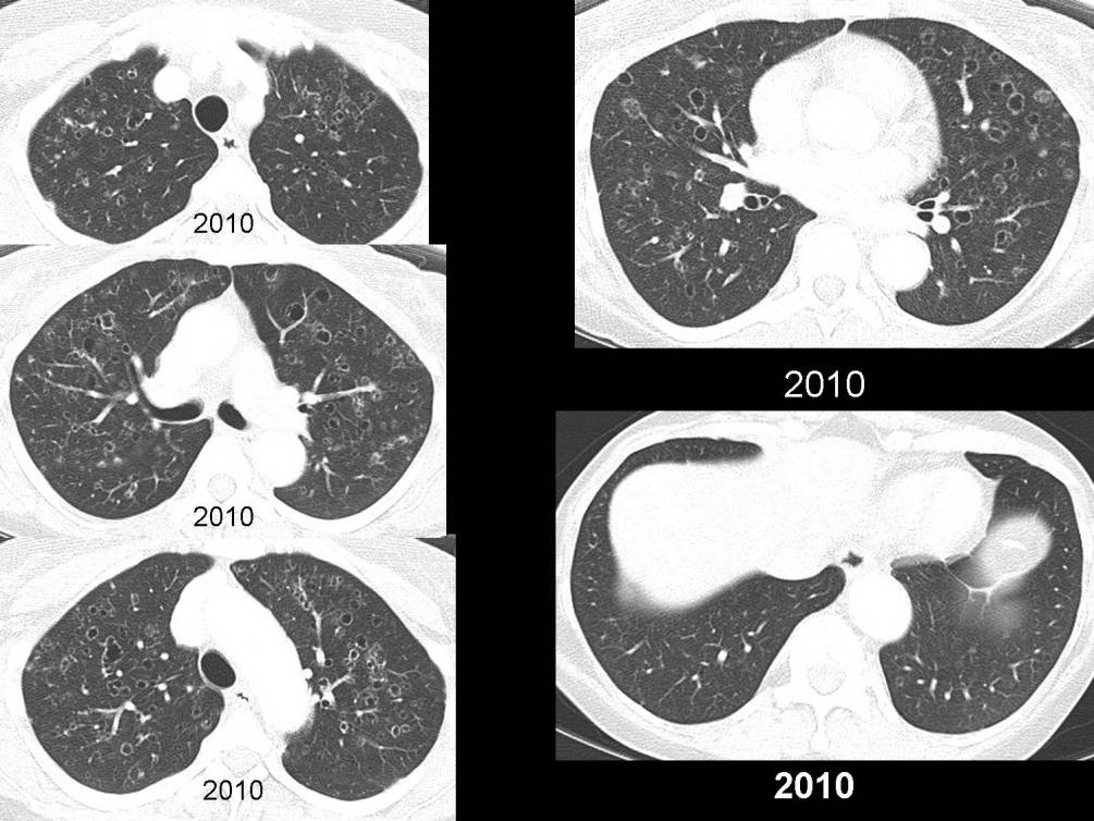 Radiograph 3 from archived case 49