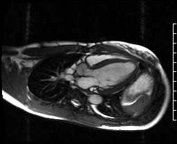 Radiograph 4 from archived case 72