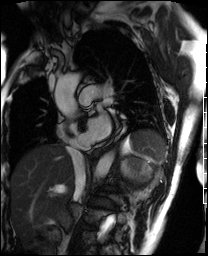 Radiograph 4 from archived case 61