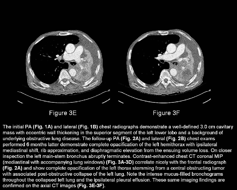 Radiograph 6 from archived case 35
