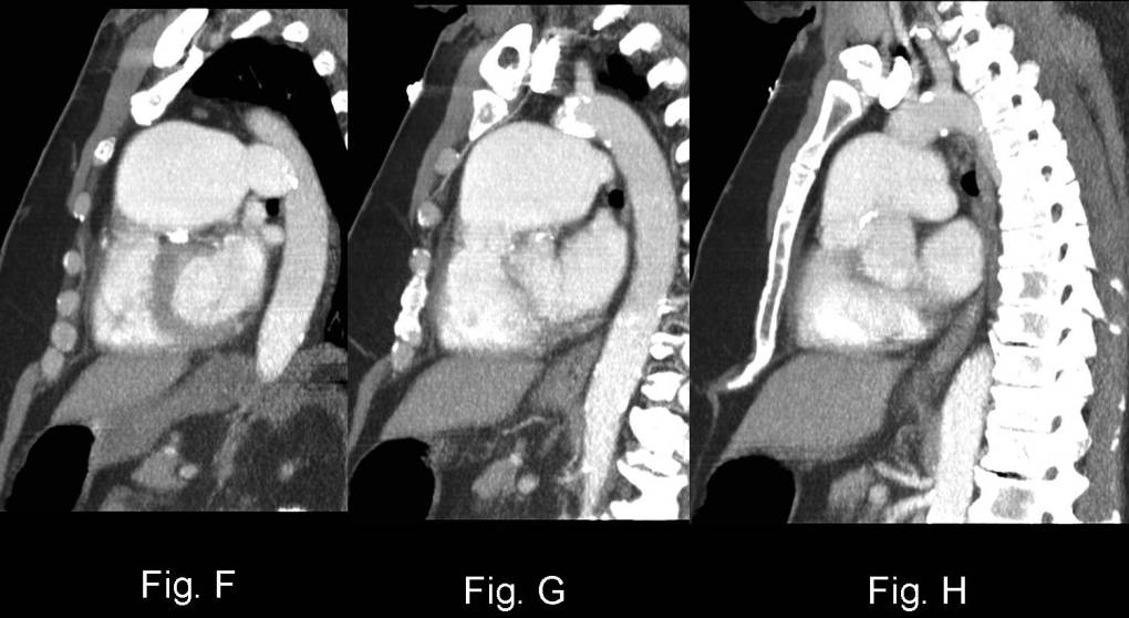Radiograph 6 from archived case 46