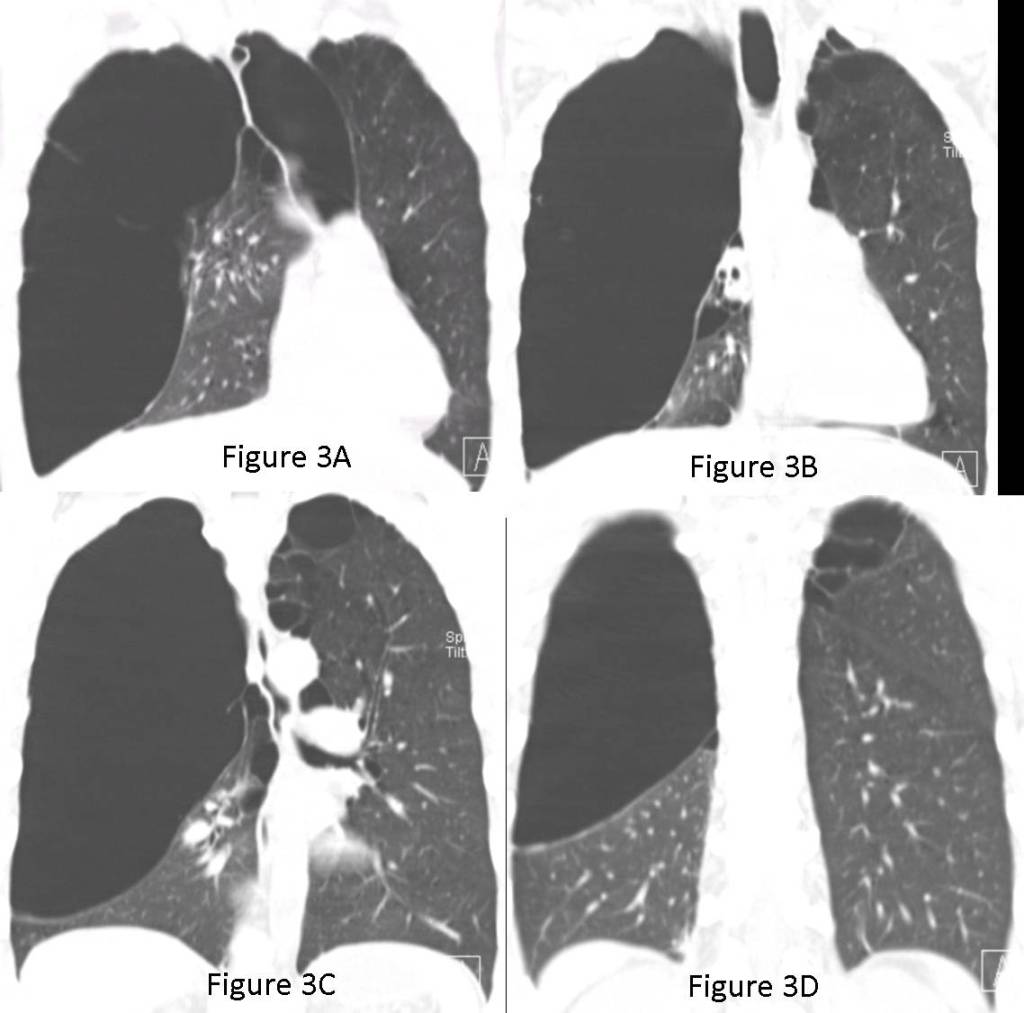 Radiograph 6 from archived case 70