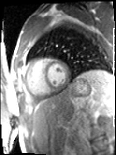 Radiograph 4 from archived case 38