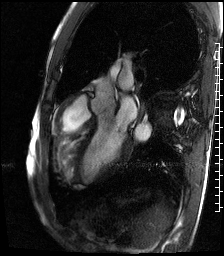 Radiograph 4 from archived case 69