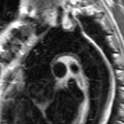 Radiograph 4 from archived case 51