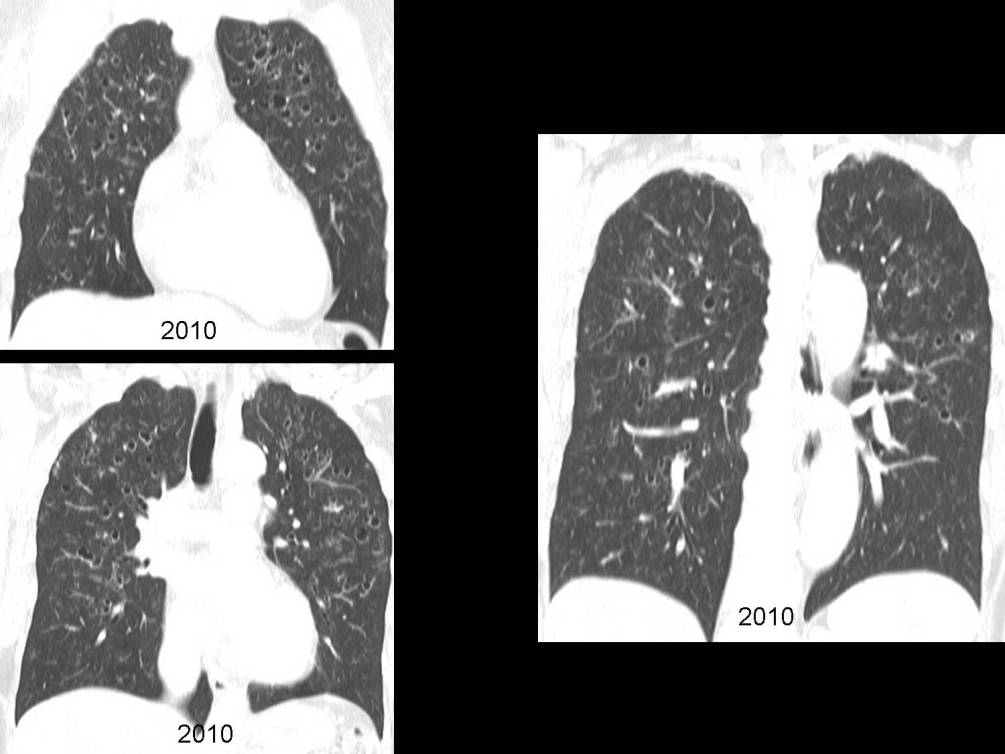 Radiograph 8 from archived case 49