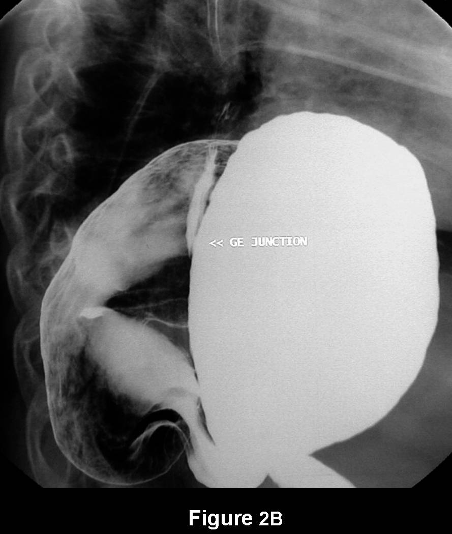 Radiograph 6 from archived case 76