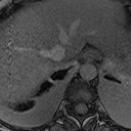 Radiograph 4 from archived case 30