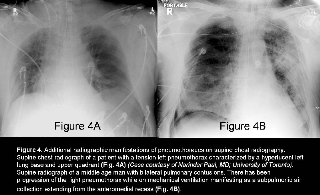 Radiograph 5 from archived case 34
