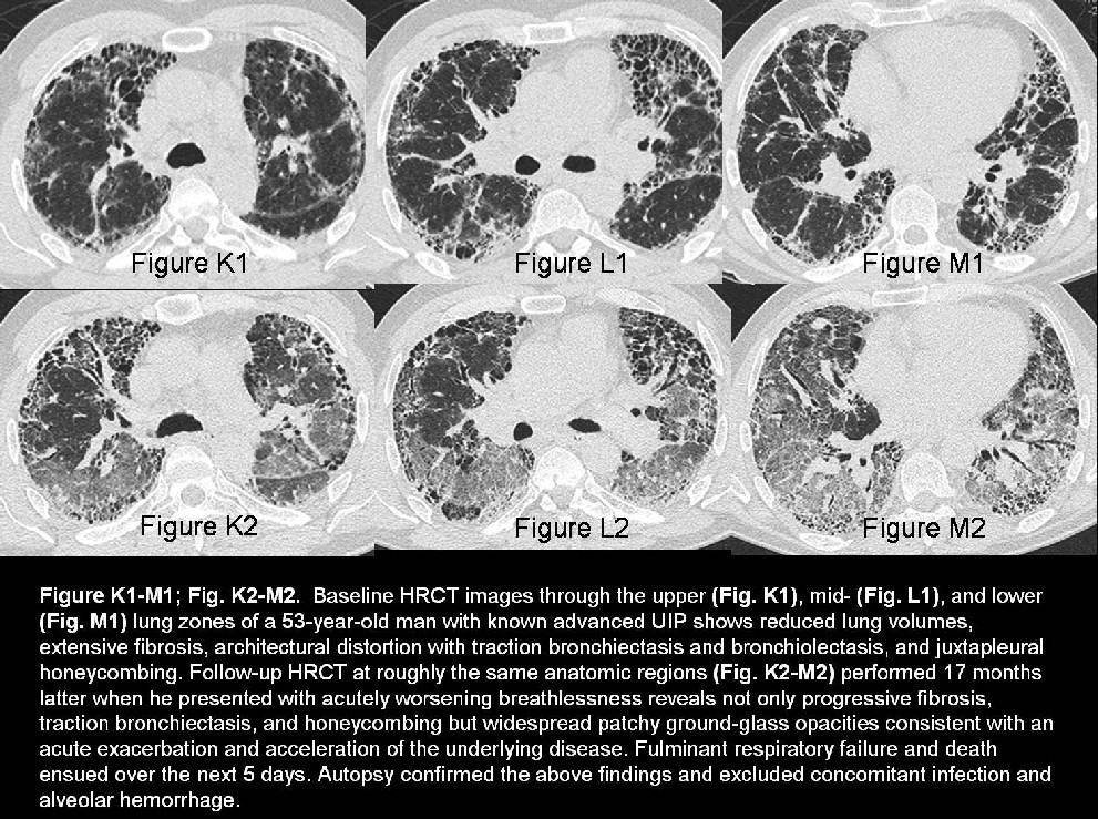 Radiograph 6 from archived case 27