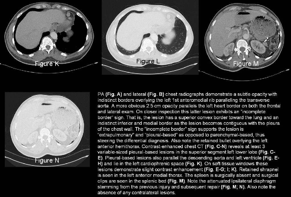 Radiograph 5 from archived case 15