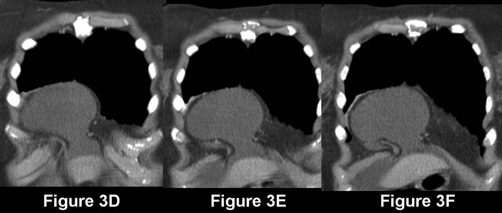 Radiograph 6 from archived case 67