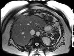 Radiograph 4 from archived case 42