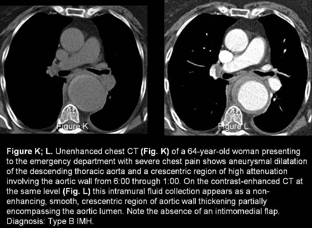 Radiograph 5 from archived case 25