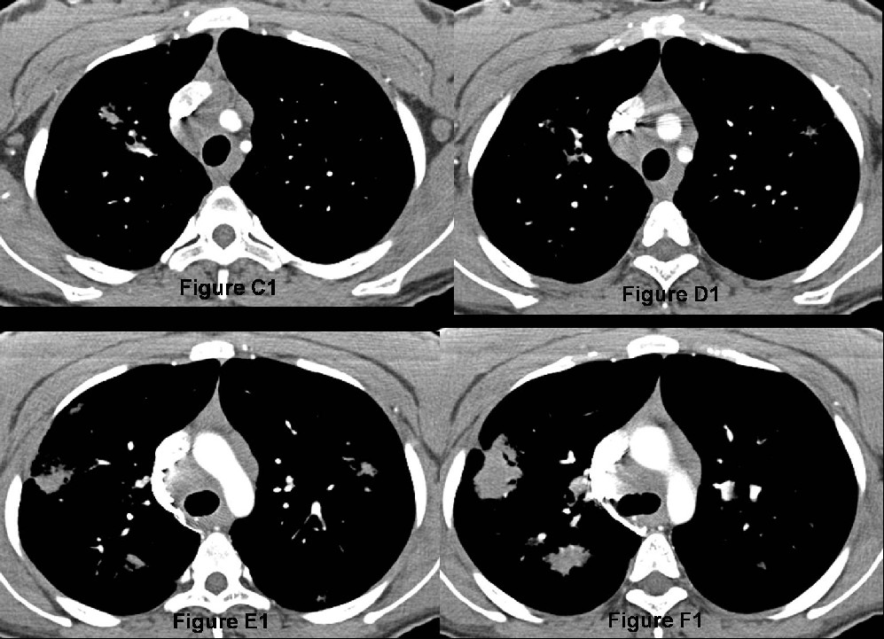 Radiograph 6 from archived case 23