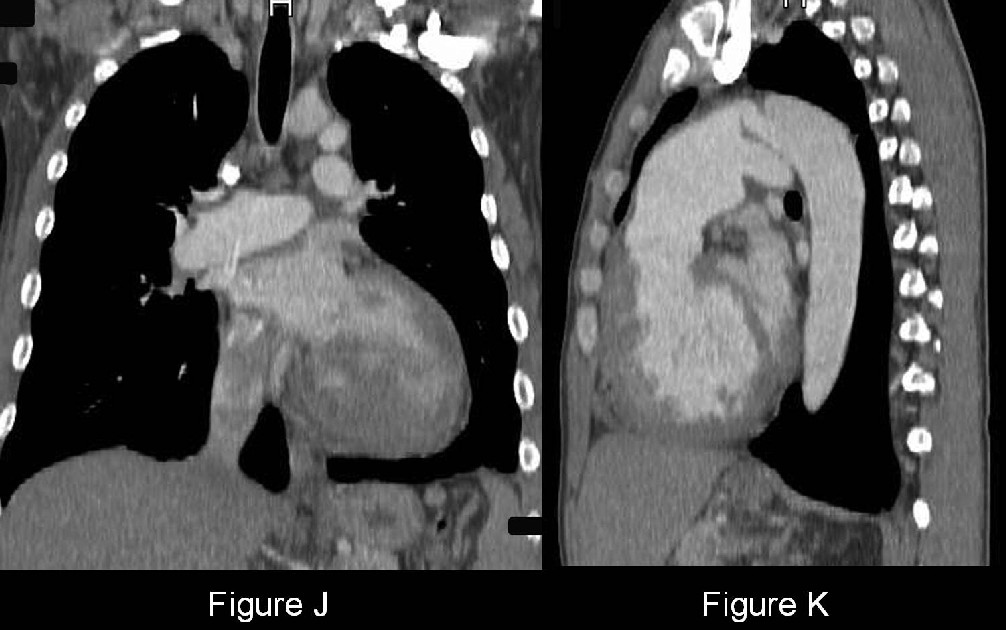 Radiograph 7 from archived case 40