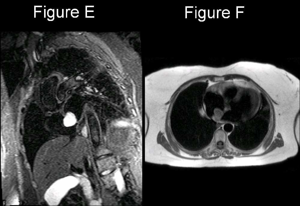 Radiograph 4 from archived case 20