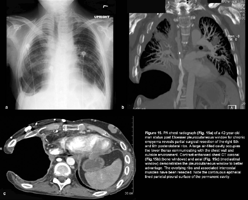 Radiograph 6 from archived case 5